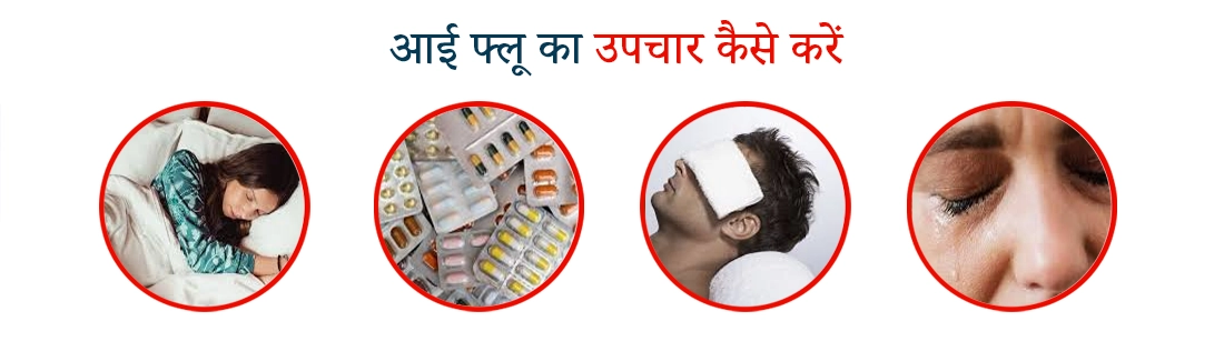 How to Treat Eye Flu in Hindi